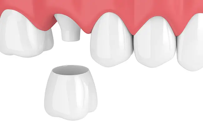 Scripps Family Dental - Family Dentist in Sacramento