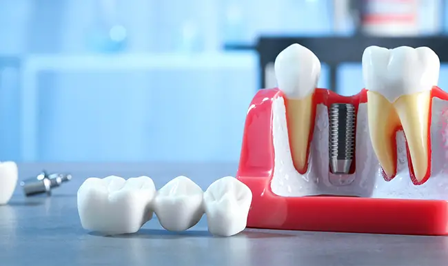 Scripps Family Dental - Family Dentist in Sacramento