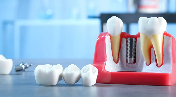 Scripps Family Dental -