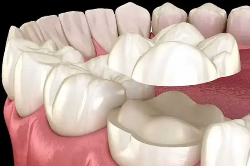 Scripps Family Dental -