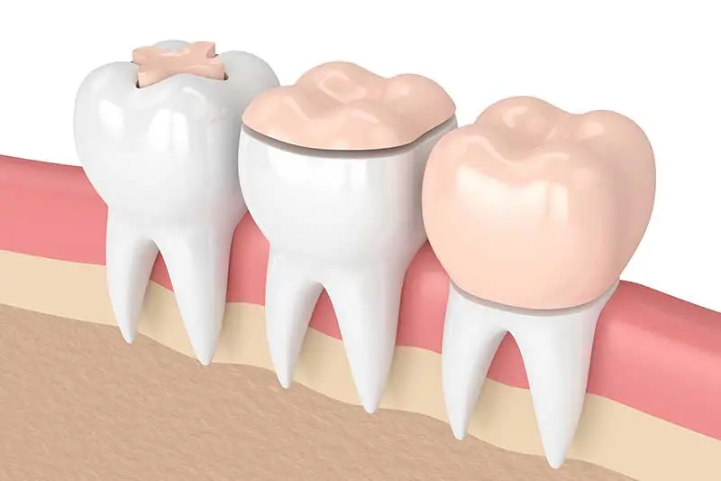 Scripps Family Dental -