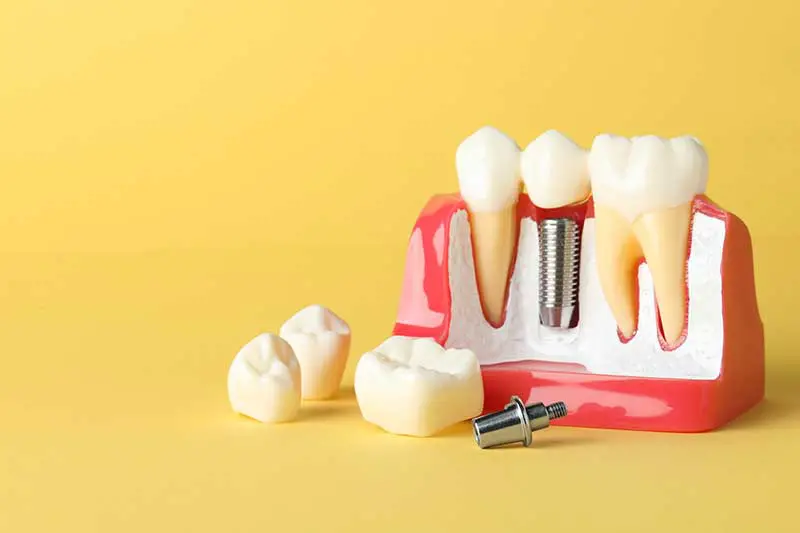 Scripps Family Dental -