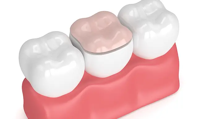 Scripps Family Dental - Family Dentist in Sacramento