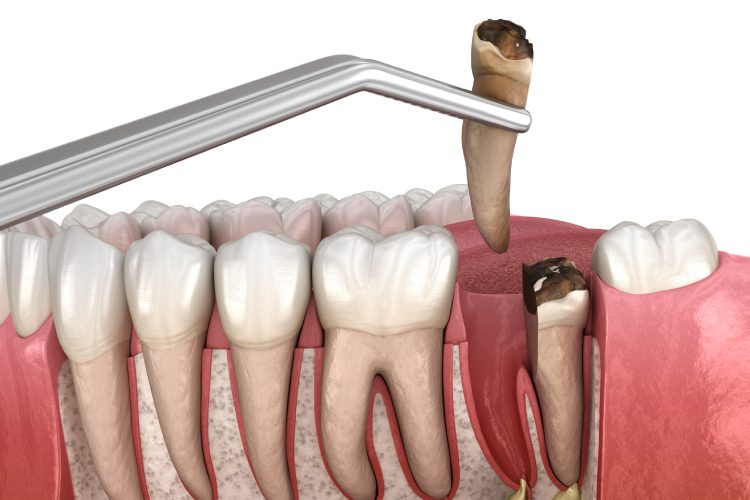 Scripps Family Dental -