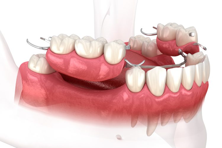 Scripps Family Dental -