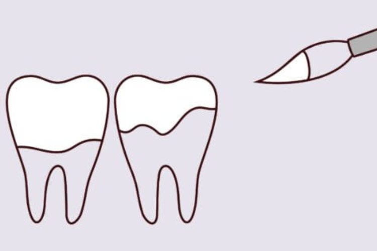 Scripps Family Dental -
