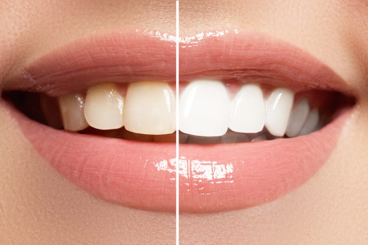 Scripps Family Dental -