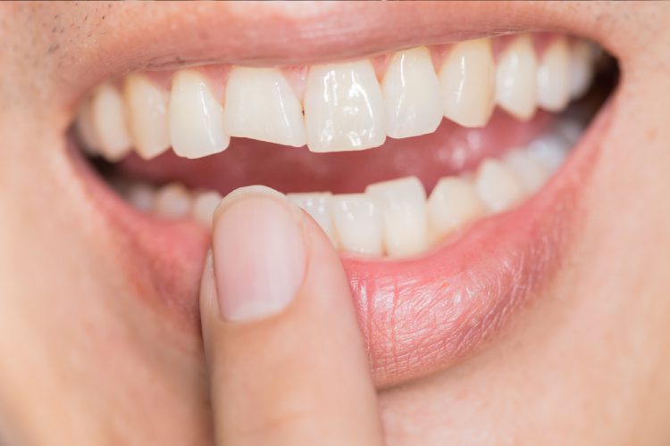 Scripps Family Dental -