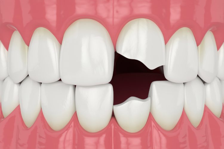 Scripps Family Dental -