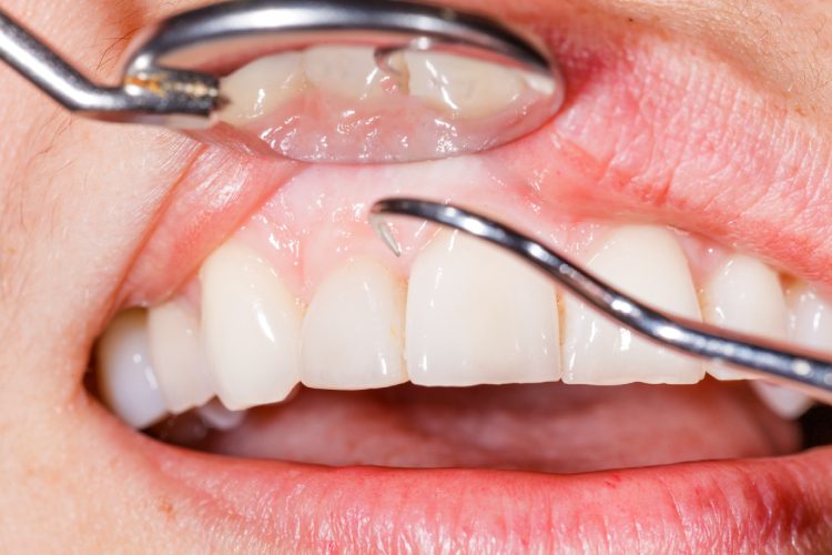 Scripps Family Dental -