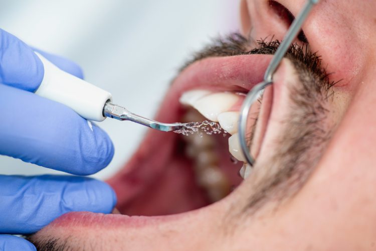 Scripps Family Dental -