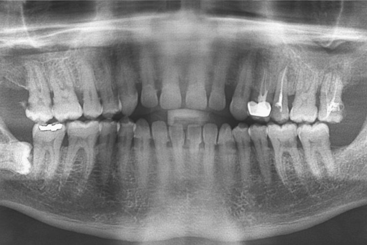 Scripps Family Dental -