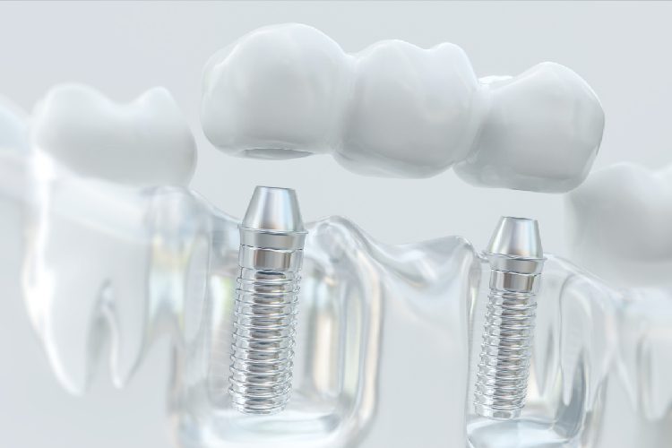 Scripps Family Dental -