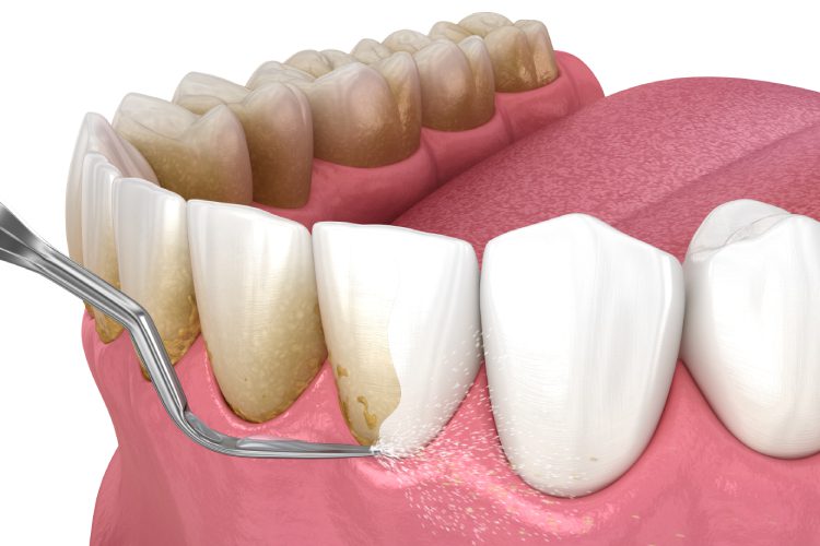 Scripps Family Dental -