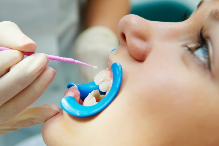 Scripps Family Dental -