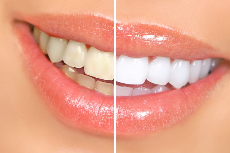 Scripps Family Dental -