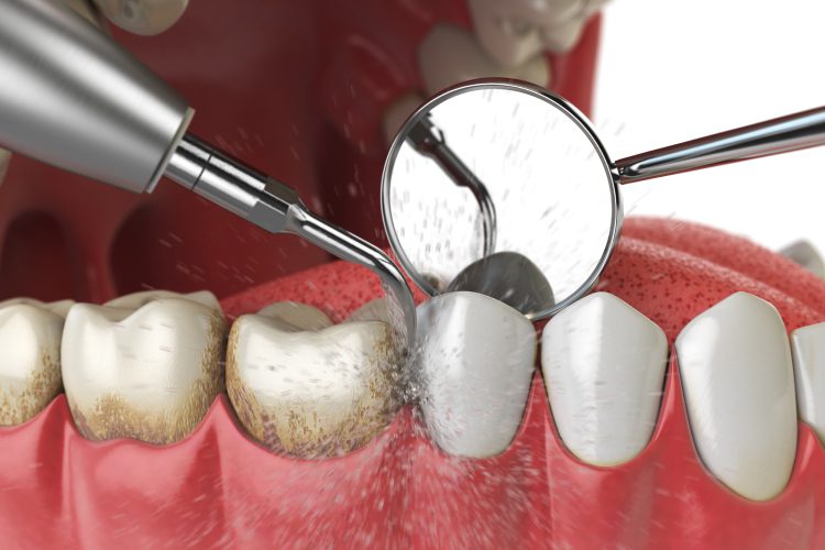 Scripps Family Dental -
