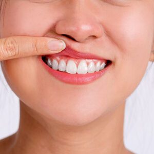 Scripps Family Dental -