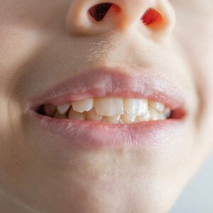 Scripps Family Dental -
