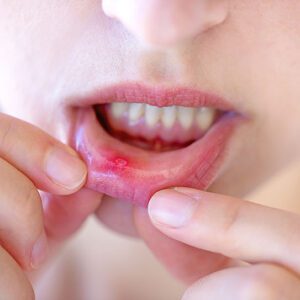 Scripps Family Dental -