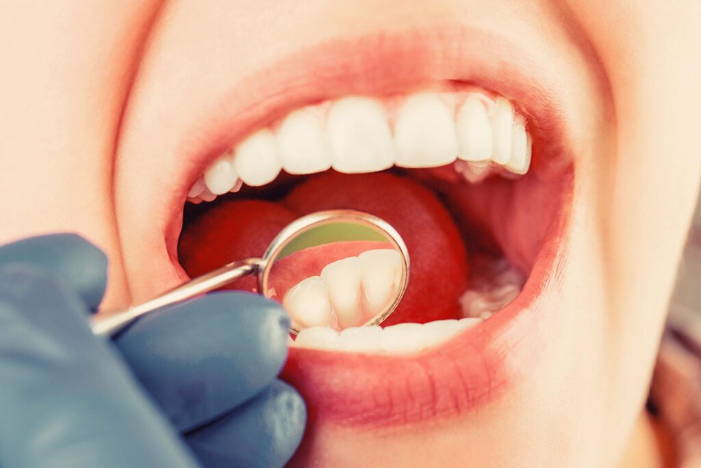 general dentistry Sacramento general dentists